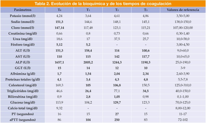 Tabla