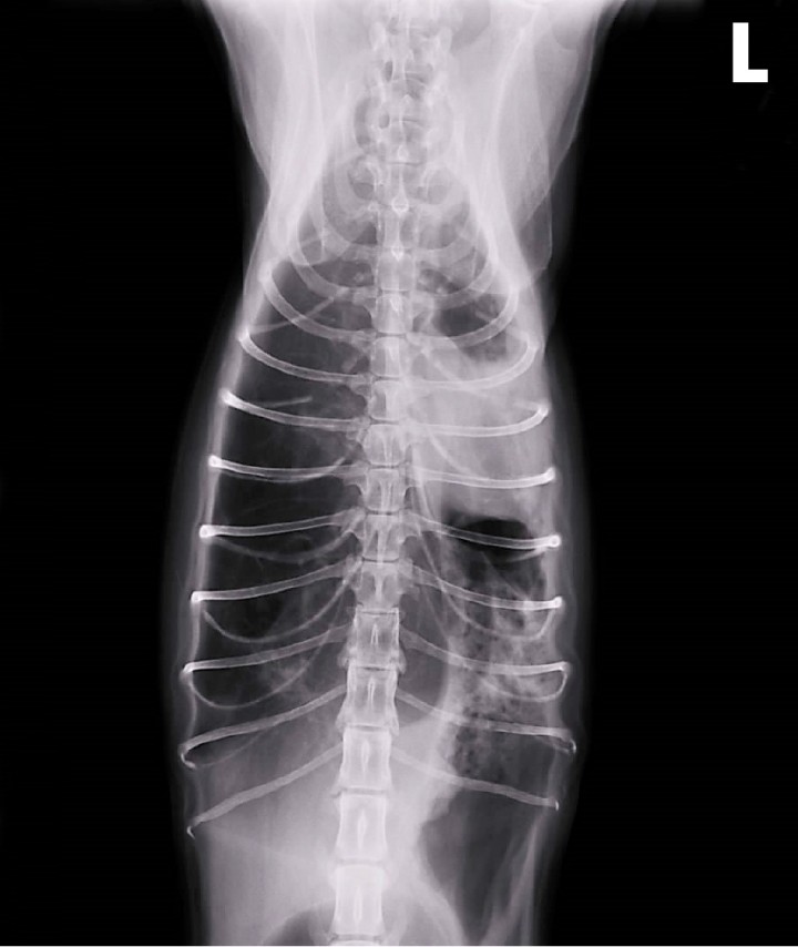 Radiografía de tórax en un paciente con enfermedad de Niemann Pick