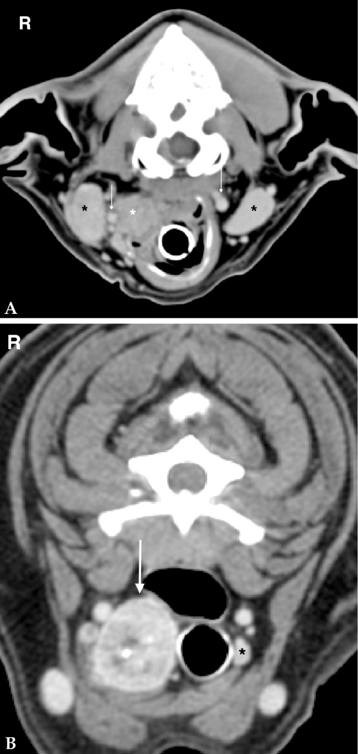 bladder cancer cause constipation