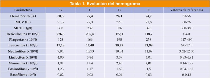 Tabla